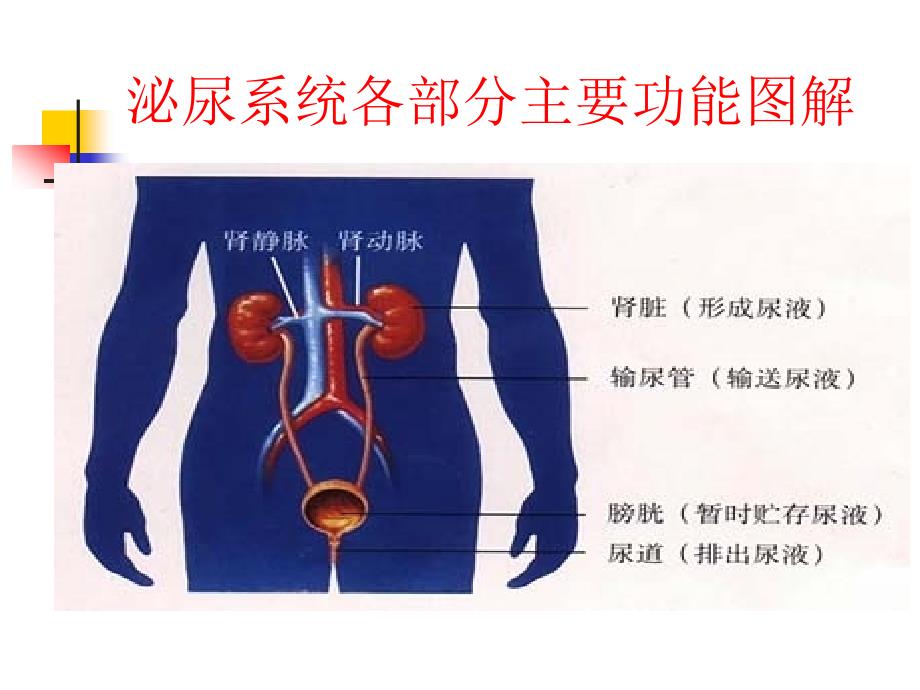 输尿管结石的护理查房课件.ppt_第3页