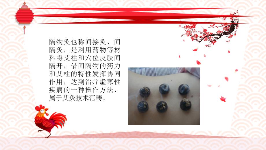 隔物灸技术课件.ppt_第2页
