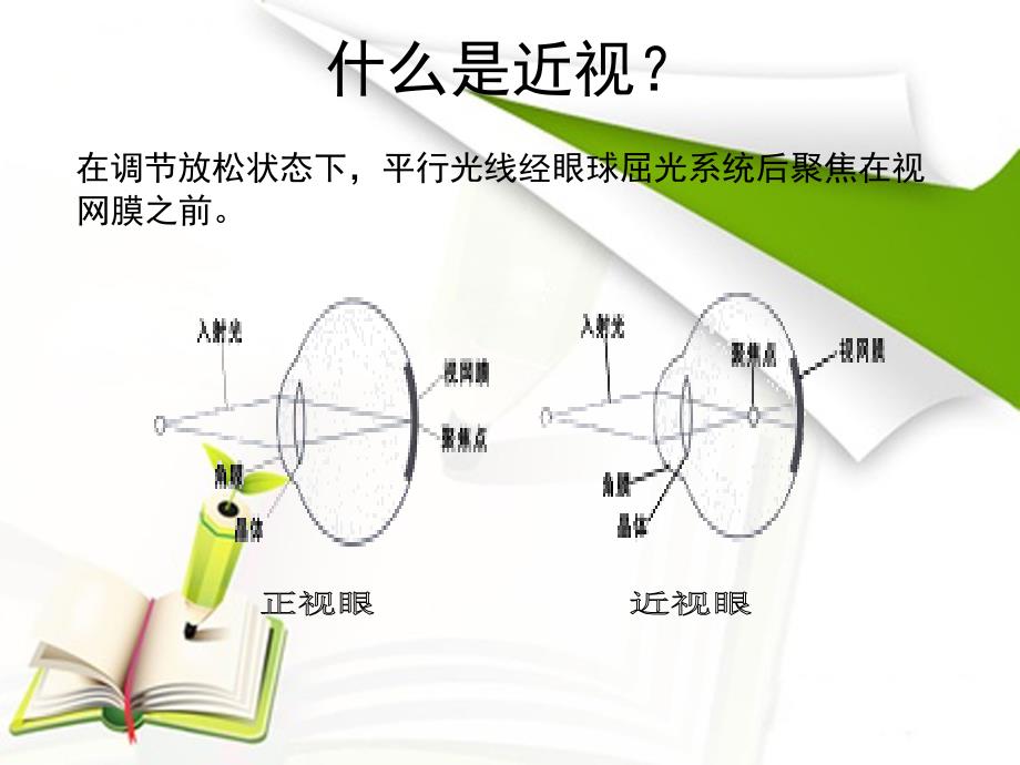 角膜塑形镜讲课课件.ppt_第3页