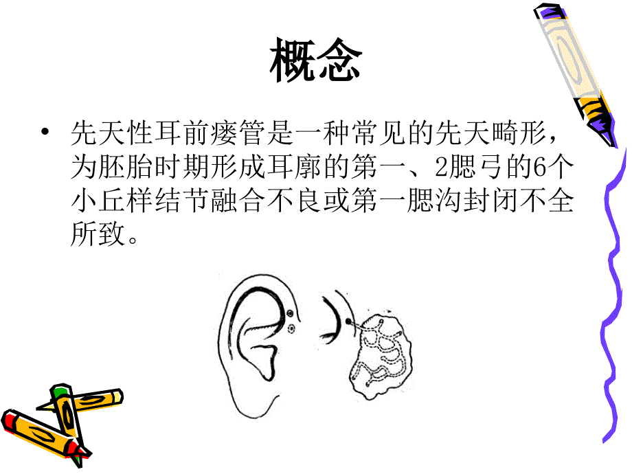 耳前瘘管.ppt_第2页