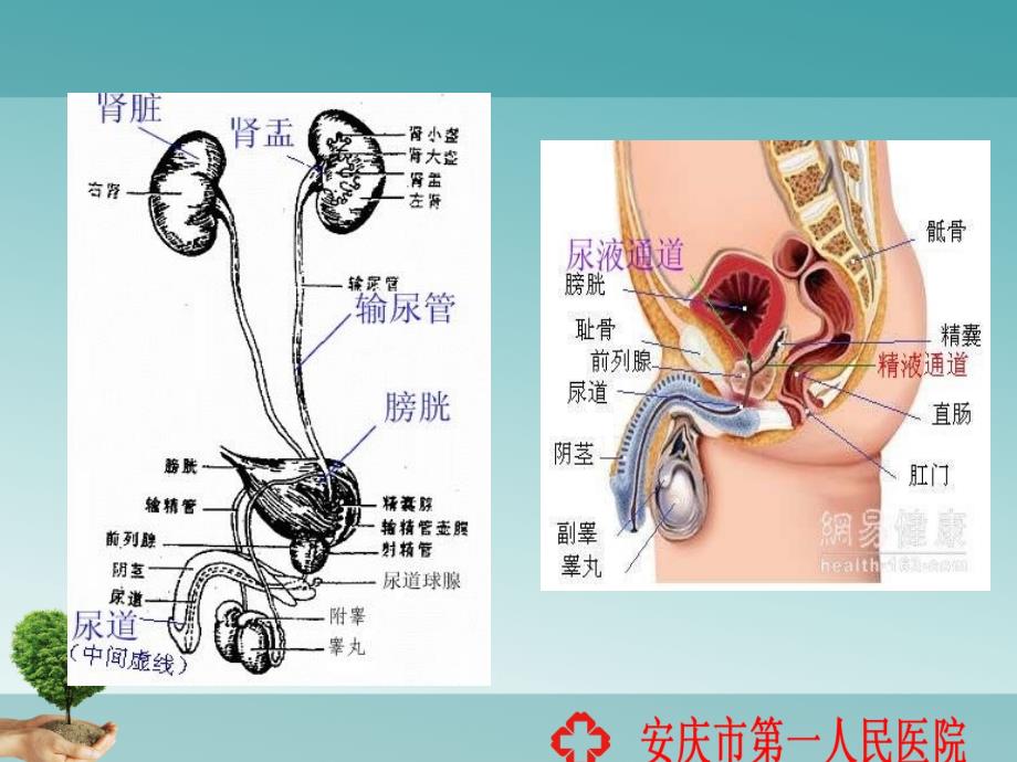 膀胱癌病人的护理PPT课件.ppt_第3页