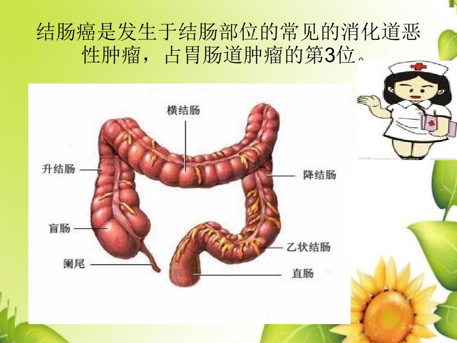 结肠癌病例讨论1ppt课件.ppt_第3页