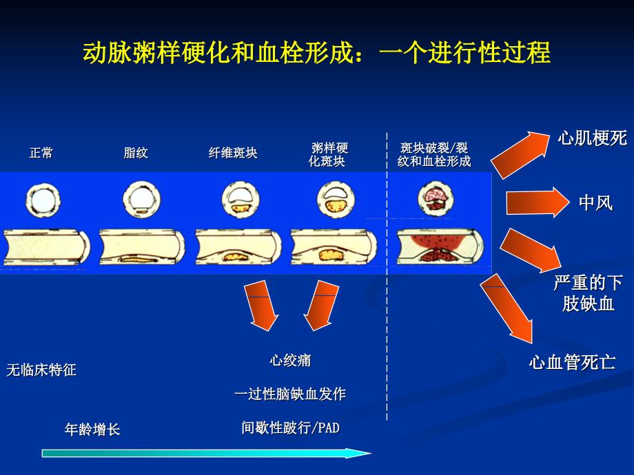 缺血性脑血管病PPT课件.ppt_第3页