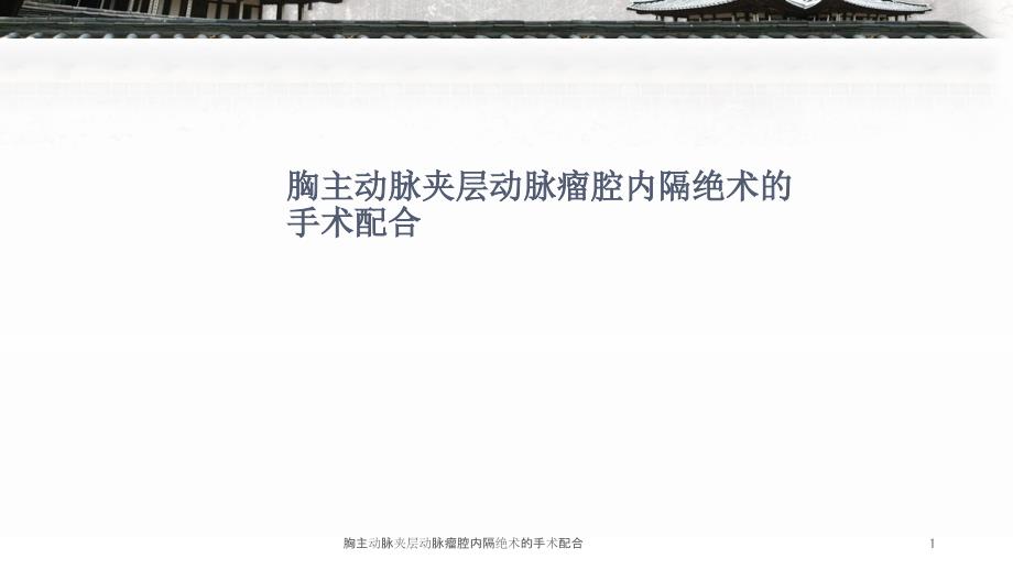 胸主动脉夹层动脉瘤腔内隔绝术的手术配合ppt课件.ppt_第1页