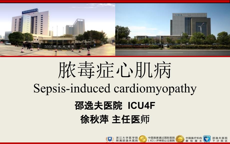 脓毒性心肌病.ppt_第1页