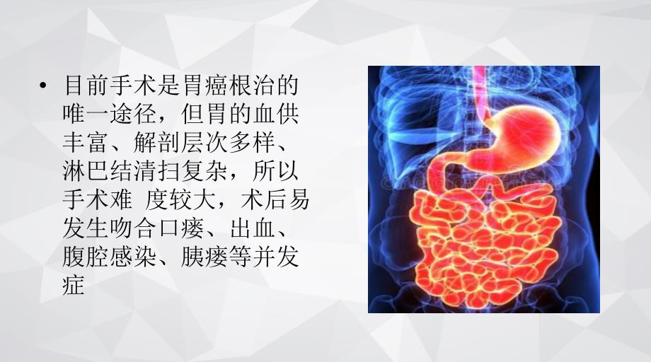 胃癌术后吻合口瘘诊治课件.pptx_第2页