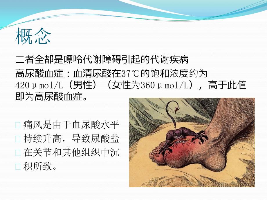 高尿酸血症与痛风.ppt_第2页