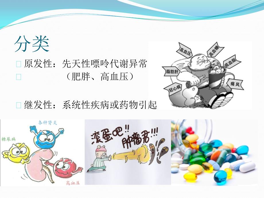 高尿酸血症与痛风.ppt_第3页