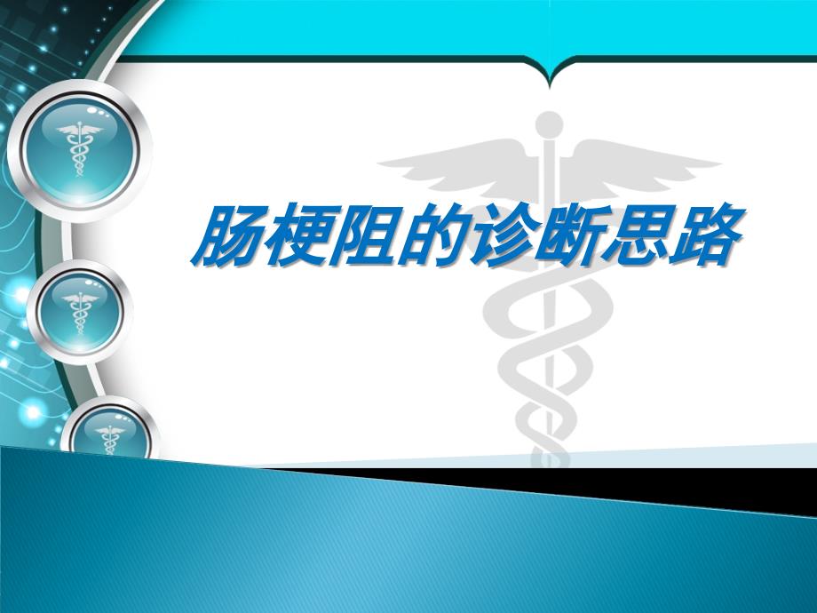 肠梗阻的诊断思维医学PPT.ppt_第1页