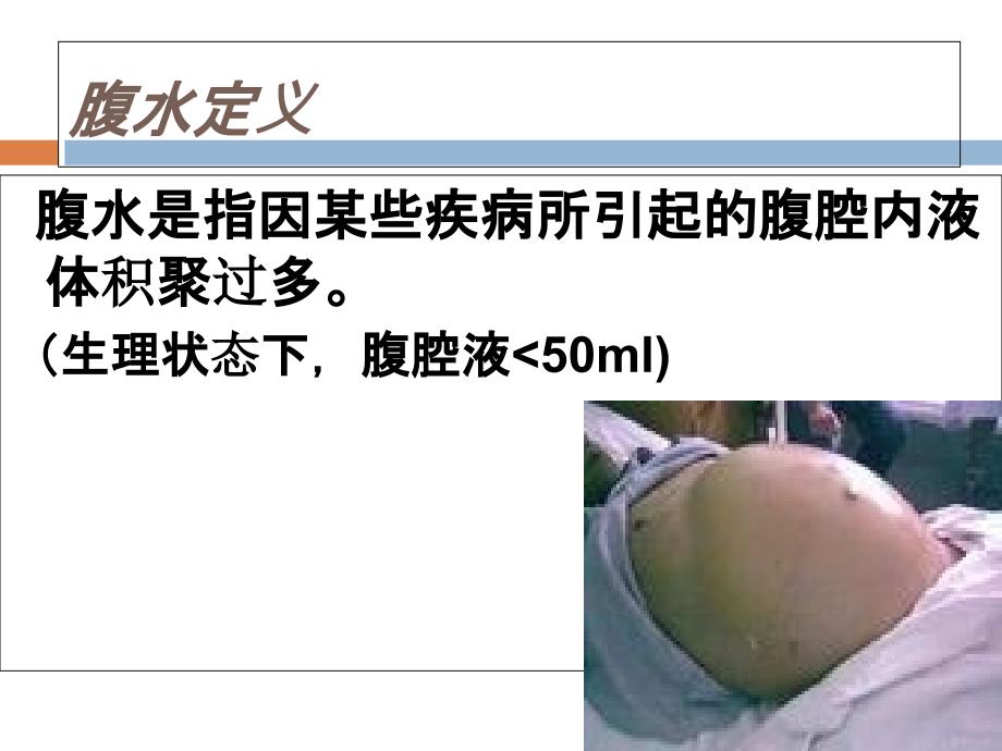 腹水查因的临床诊断思路.ppt_第3页
