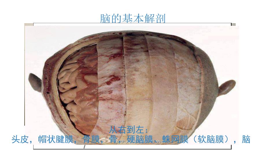 神经外科引流管的护理.ppt_第3页