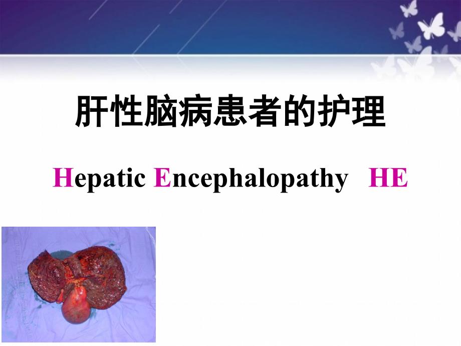 肝性脑病的护理PPT课件.ppt_第2页