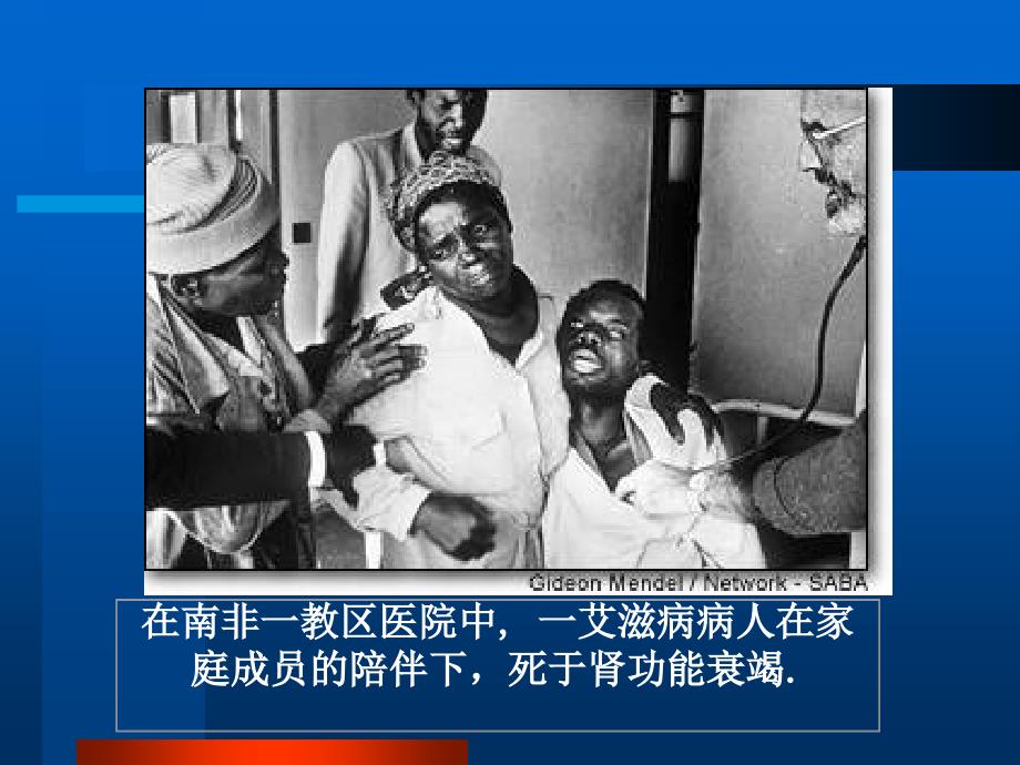 艾滋病病人的护理PPT课件.ppt_第2页