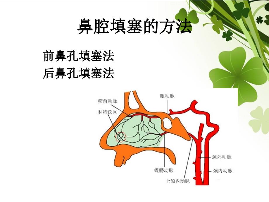 鼻腔填塞课件.ppt_第3页