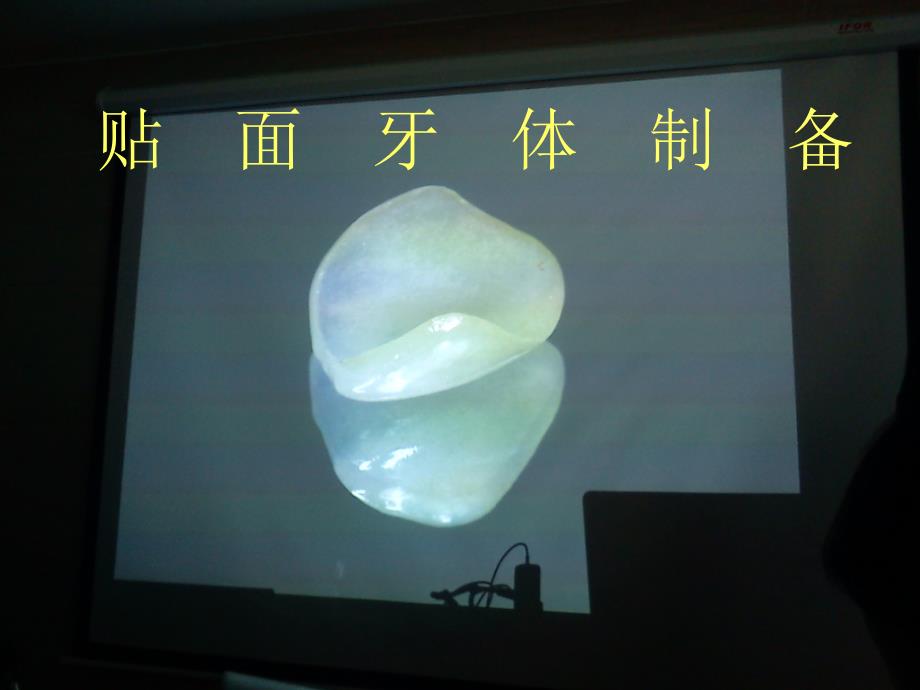 贴面牙体制备PPT课件.ppt_第1页