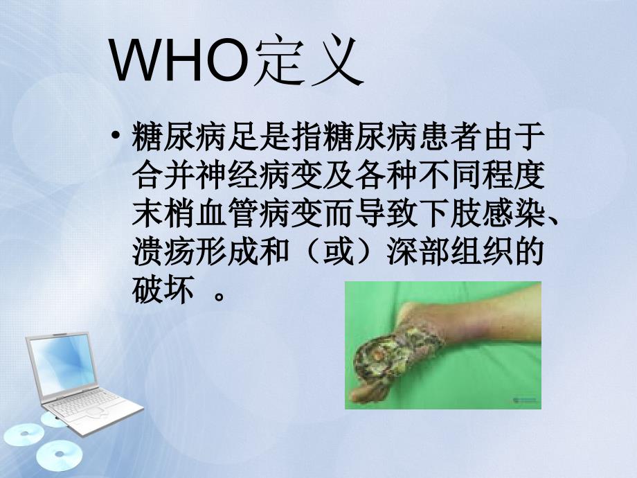 糖尿病足截肢的护理常规.ppt_第2页