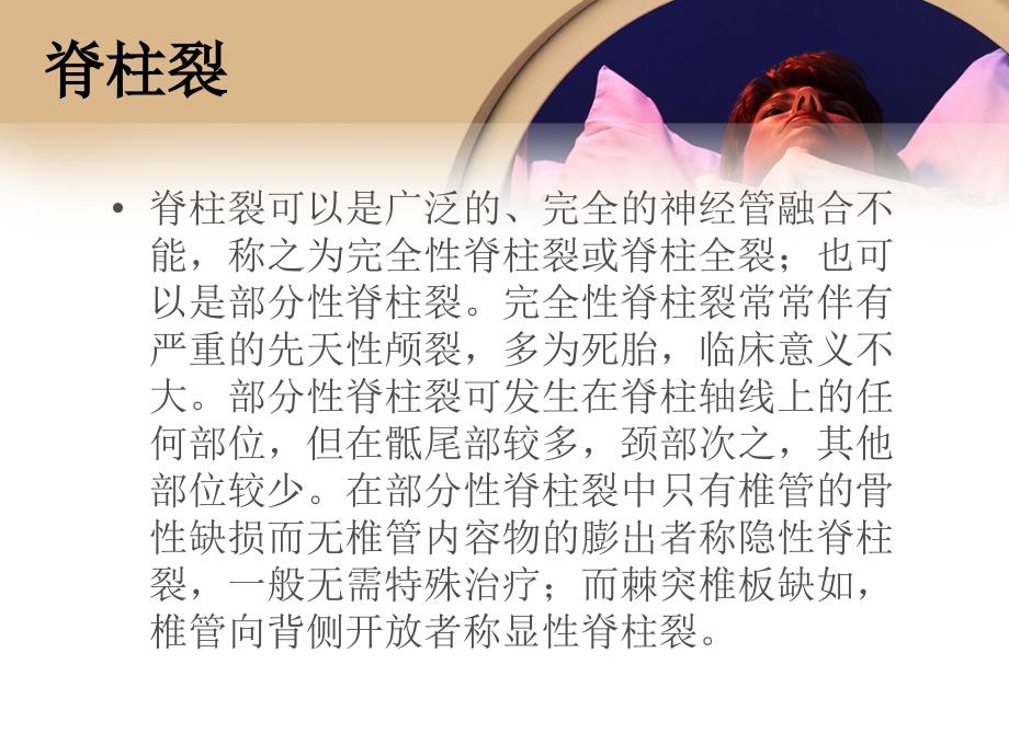 脊柱裂PPT课件.ppt_第2页