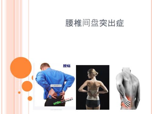 腰椎间盘突出症PPT课件.pptx