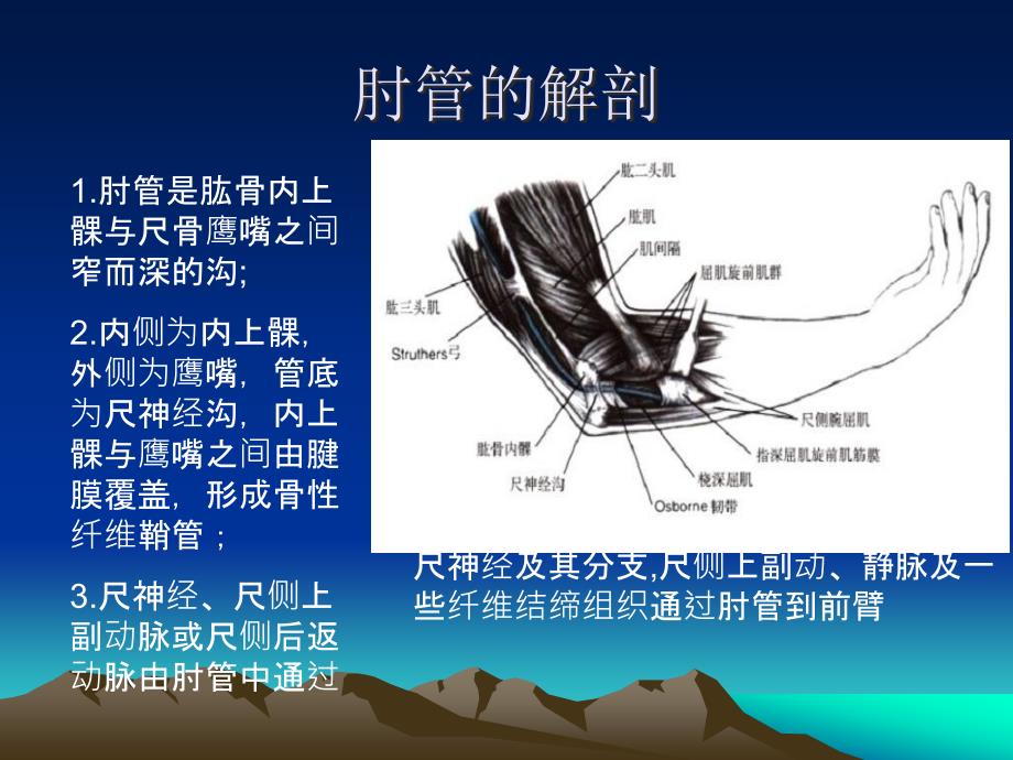 肘管综合征PPT课件.ppt_第3页