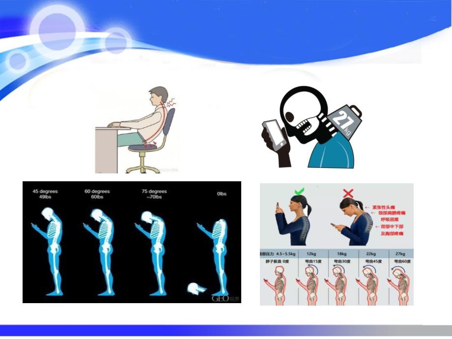 颈椎病防治及健康教育.ppt_第3页