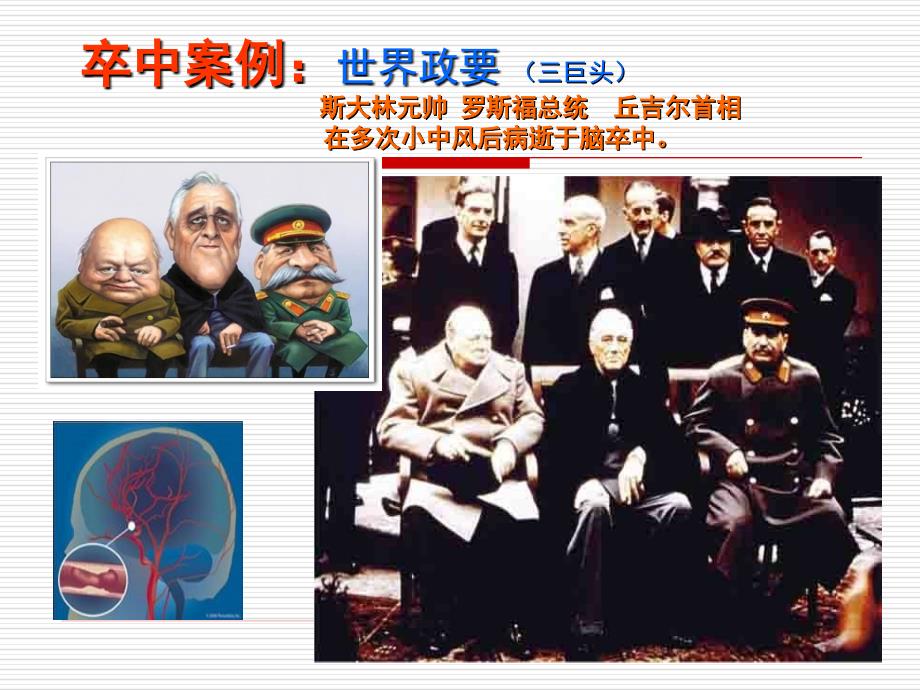 脑出血病人的治疗护理和预防.ppt_第3页