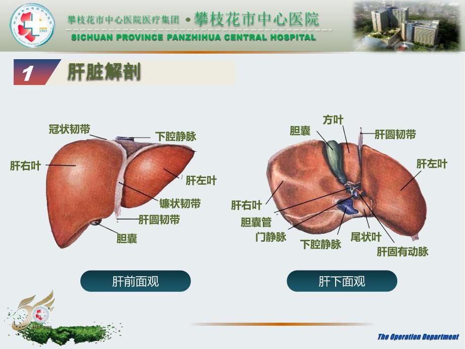腹腔镜肝切除手术配合课件.pptx_第3页