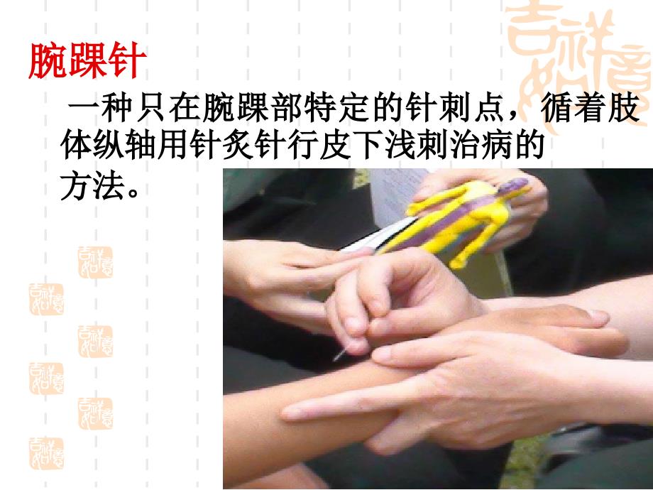 腕踝针的应用PPT课件.ppt_第3页