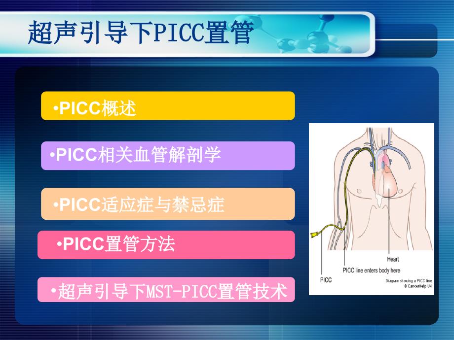 超声引导PICC置管.ppt_第2页