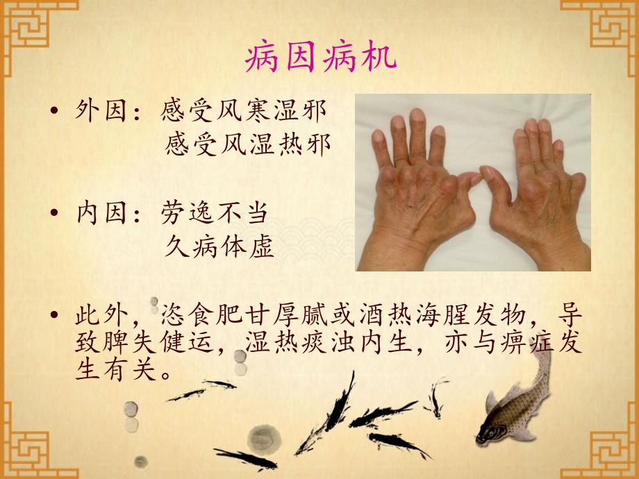 类风湿性关节炎.ppt_第3页