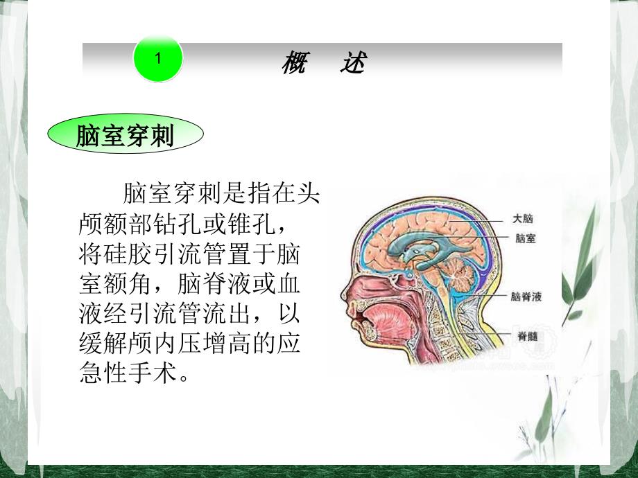 脑室引流的护理PPT课件.ppt_第3页