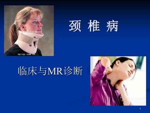 颈椎病的MRI诊断.ppt