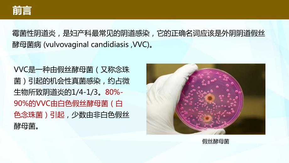 霉菌性阴道炎VVC的分类及诊治课件.pptx_第2页