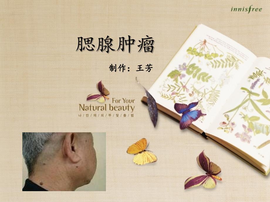 腮腺肿瘤小讲课.ppt_第1页