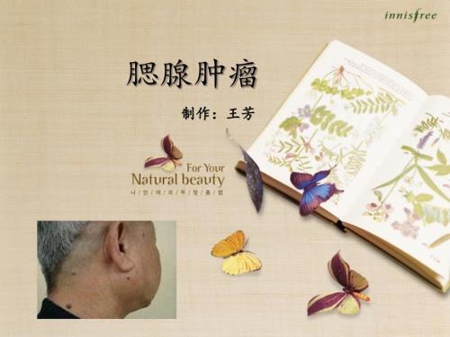 腮腺肿瘤小讲课.ppt