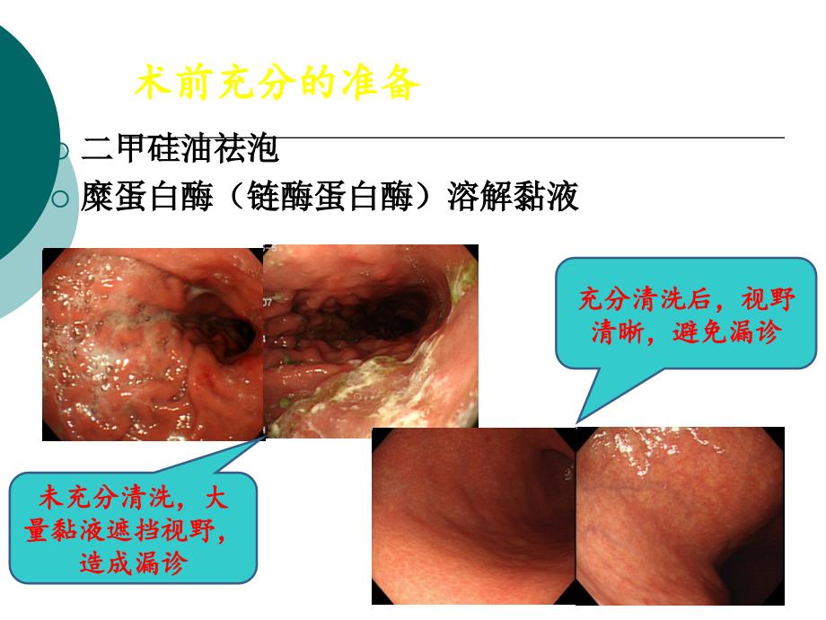 胃肠镜检查前准备及相关指南解读.ppt_第2页