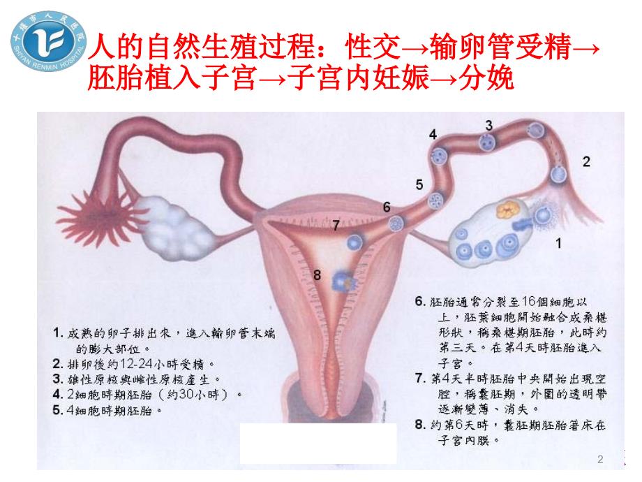 试管婴儿知识宣讲PPT参考幻灯片.ppt_第2页
