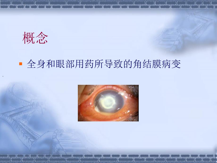 药源性角结膜病变PPT课件.ppt_第2页