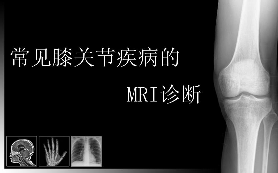 膝关节MRI课件.ppt_第1页