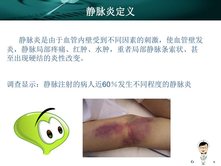 静脉炎的预防及护理.ppt_第3页