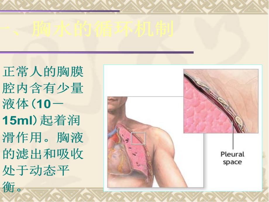 胸腔积液PPT课件.ppt_第3页