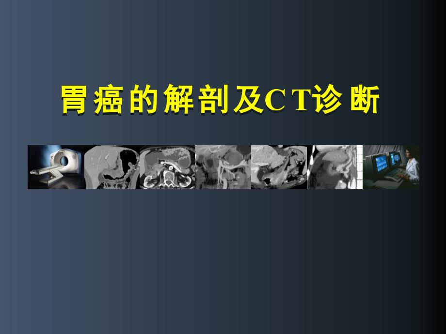 胃癌的解剖及CT诊断PPT演示课件.ppt_第1页