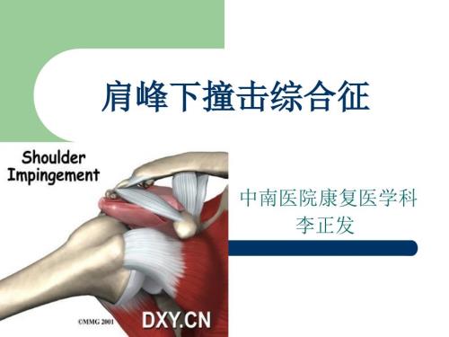 肩峰下撞击综合征.ppt