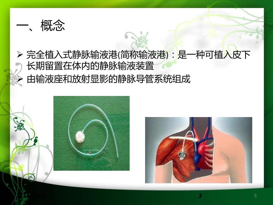 输液港的护理PPT课件.ppt_第3页