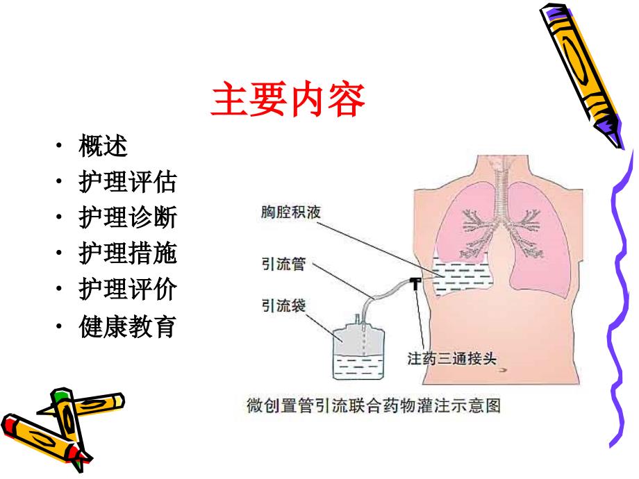 胸腔积液护理查房.ppt_第2页