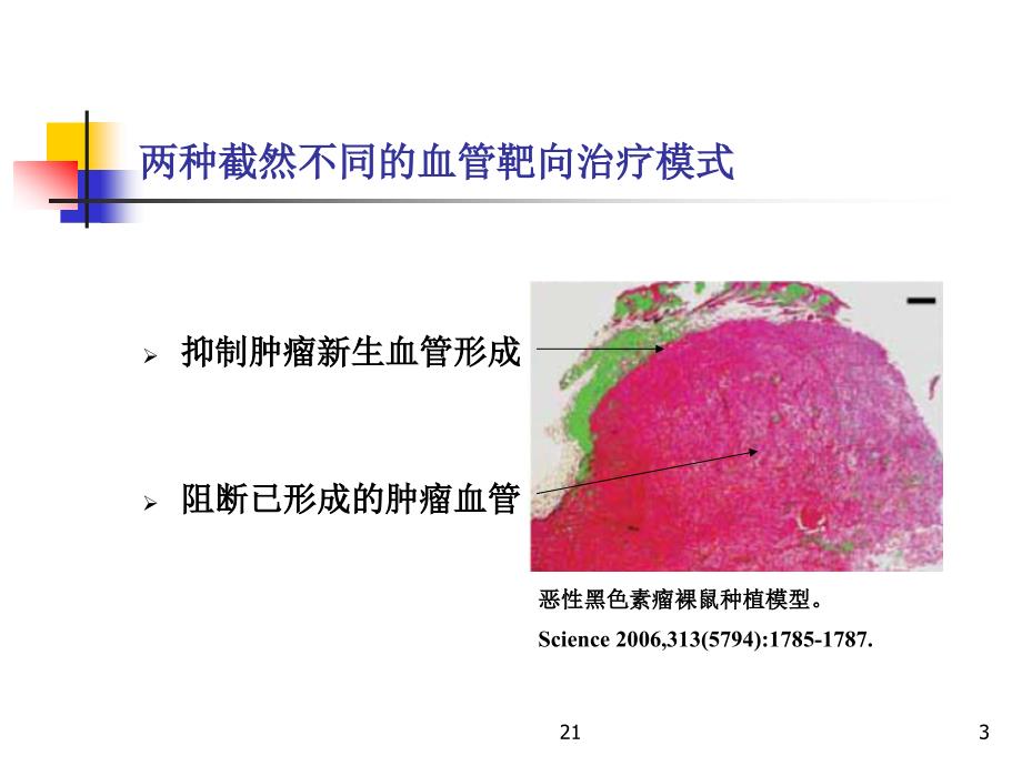 肿瘤血管阻断剂一类崭新的肿瘤血管靶向治疗药物.ppt_第3页