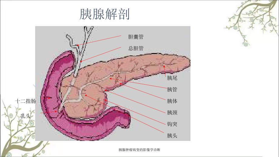 胰腺肿瘤病变的影像学诊断.ppt_第2页