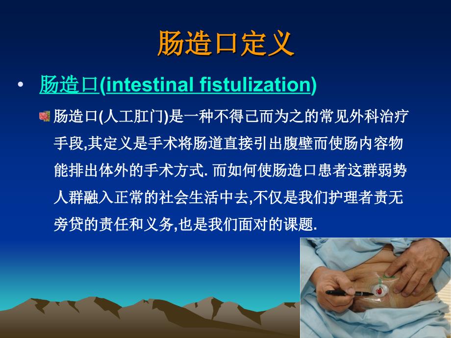 肠造口的护理PPT课件.ppt_第2页