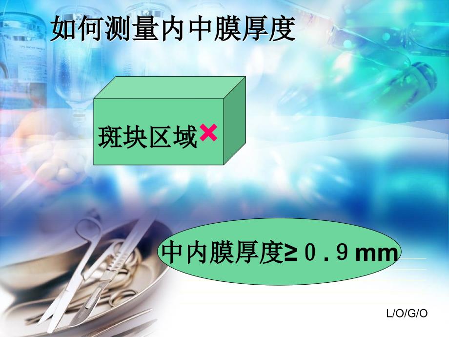 颈动脉斑块超声评价ppt课件.ppt_第2页
