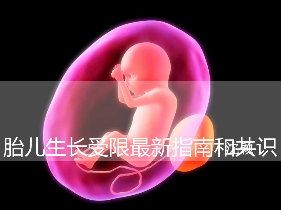胎儿生长受限最新指南和共识PPT课件.ppt_第1页