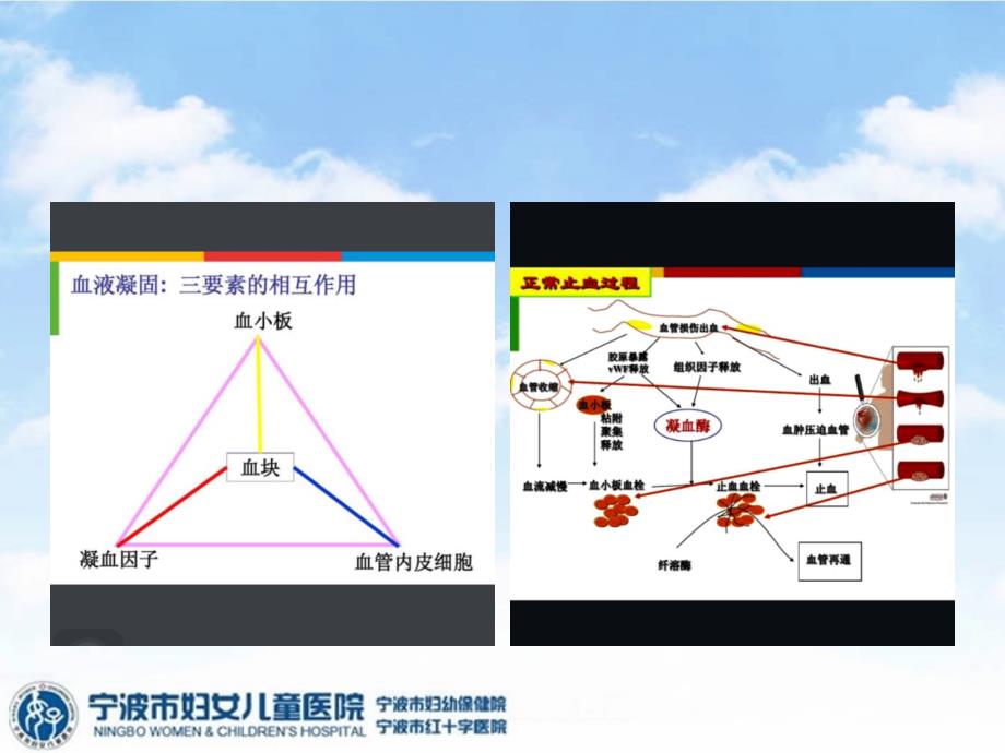 血友病ppt课件.ppt_第2页